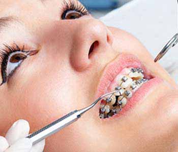 Straighten teeth with orthopedic orthodontics in Turlock, CA