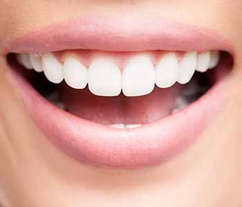 Image of white teeth