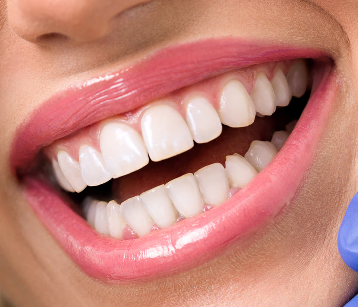 What are the Cosmetic Dental Benefits in Turlock, CA Area?